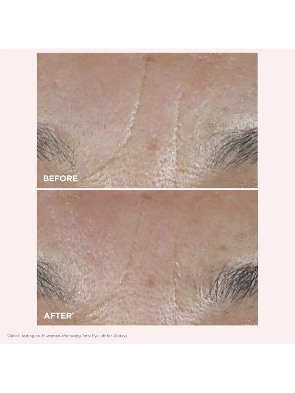 Clarins Total Eye Lift • Eye Concentrate • Brand New in Box - Picture 8 of 8